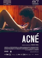 Acné (2008) Обнаженные сцены