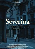 Severina  (2017) Обнаженные сцены