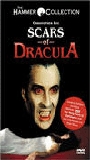 Scars of Dracula (1970) Обнаженные сцены